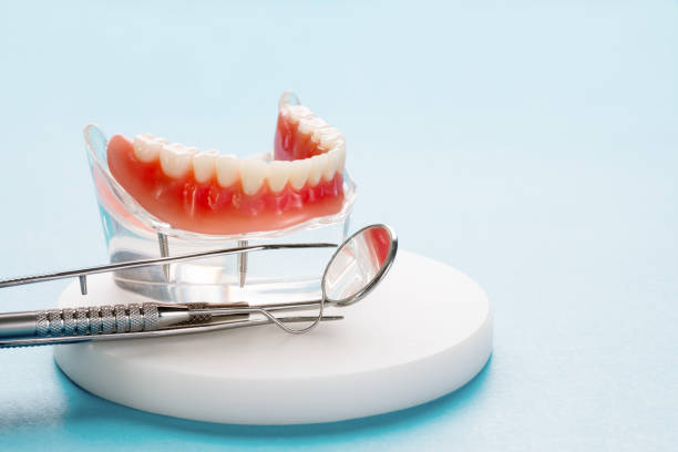 Best Veneers and Lumineers  in Underwood Petersville, AL